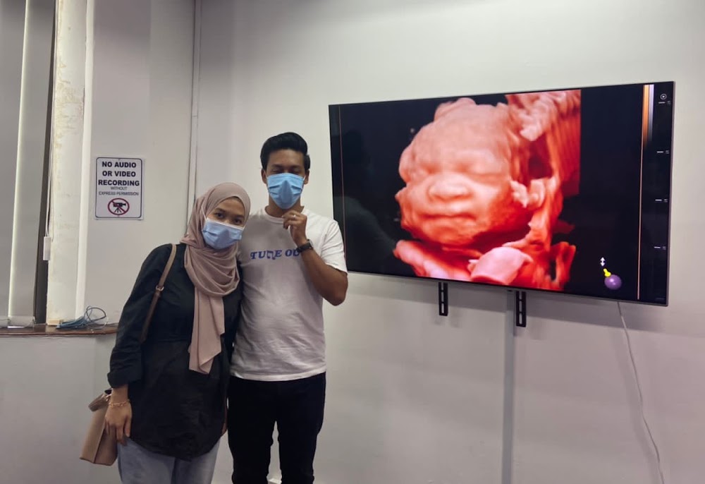 Sonovision Ultrasound Kelana Jaya Petaling Jaya