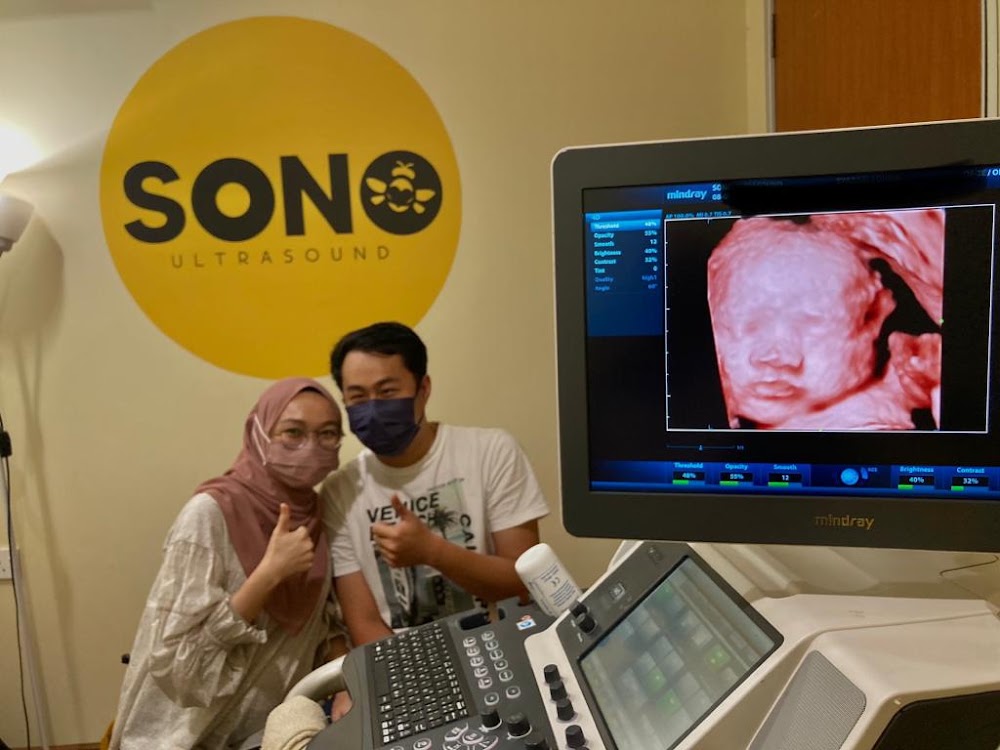 SONOBEE ULTRASOUND SHAH ALAM