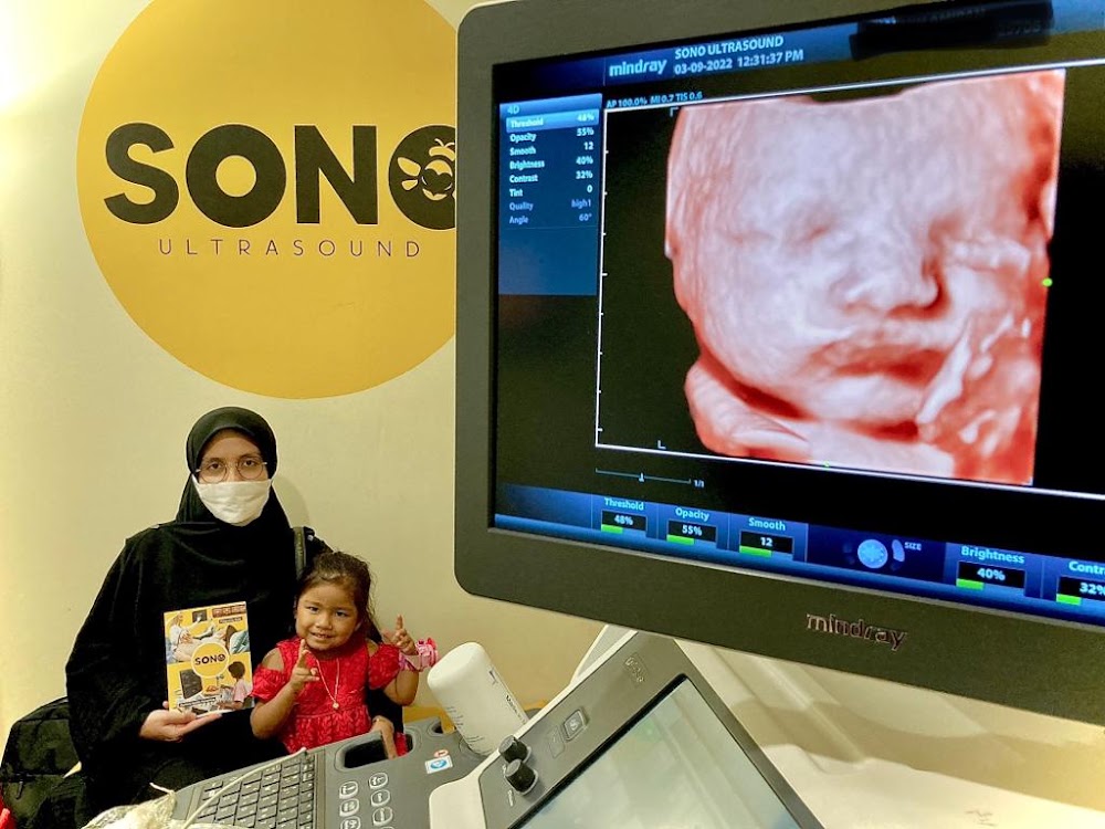 SONOBEE ULTRASOUND PUCHONG