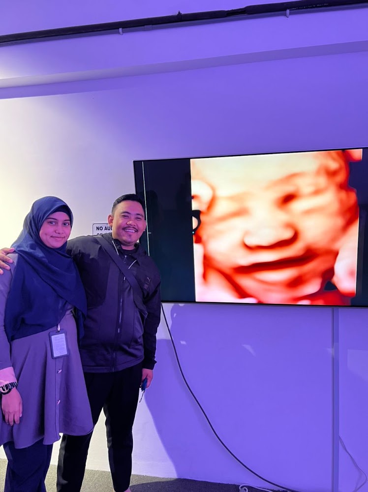Sonovision Ultrasound Sentul Kuala Lumpur